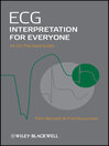 ECG Interpretation for Everyone (eBook): An On-The-Spot  Guide
